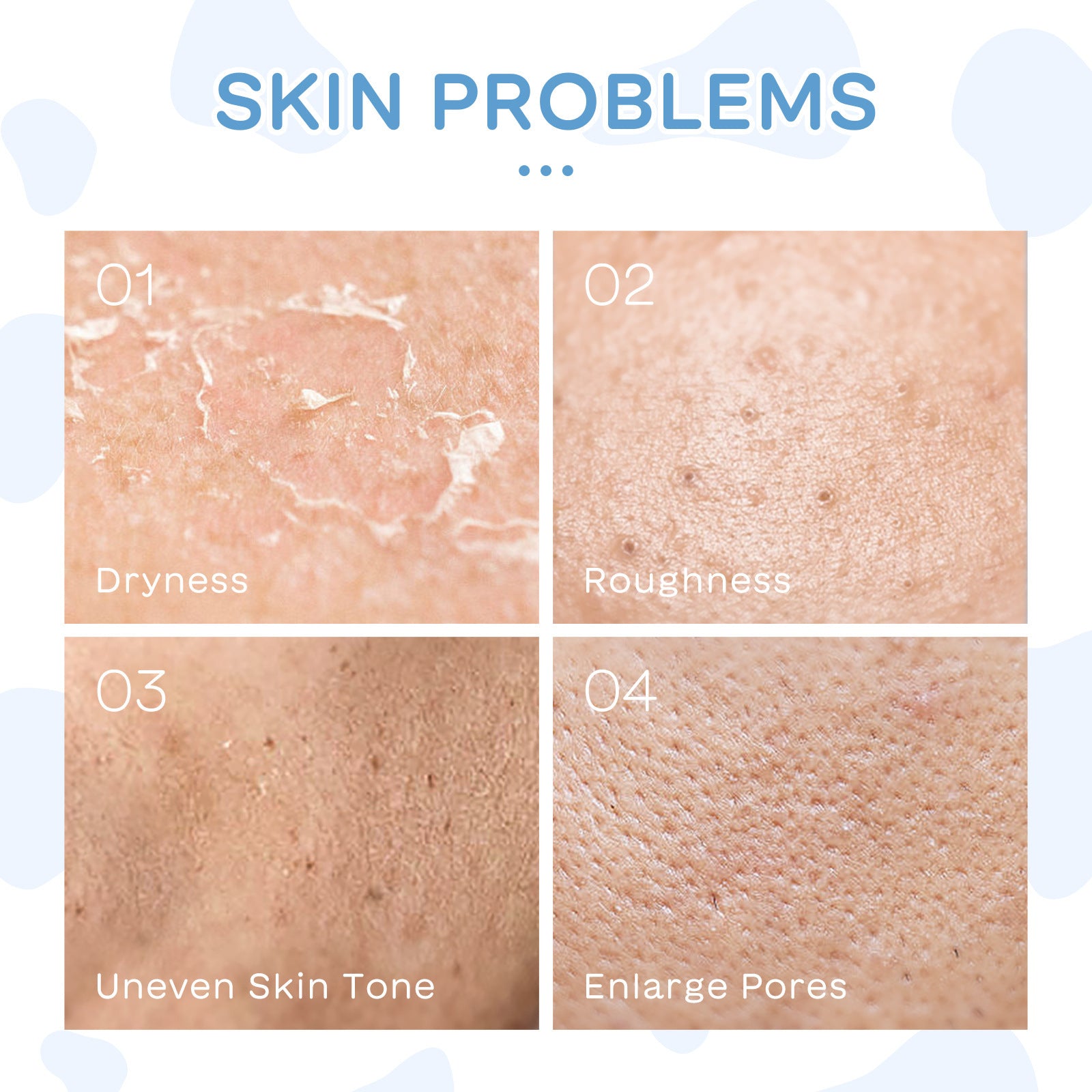 Milk Skin Care 5-piece Set Moisturizing Facial Care Suit.