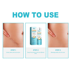 Lighten Scar Care Spray On Body Skin.