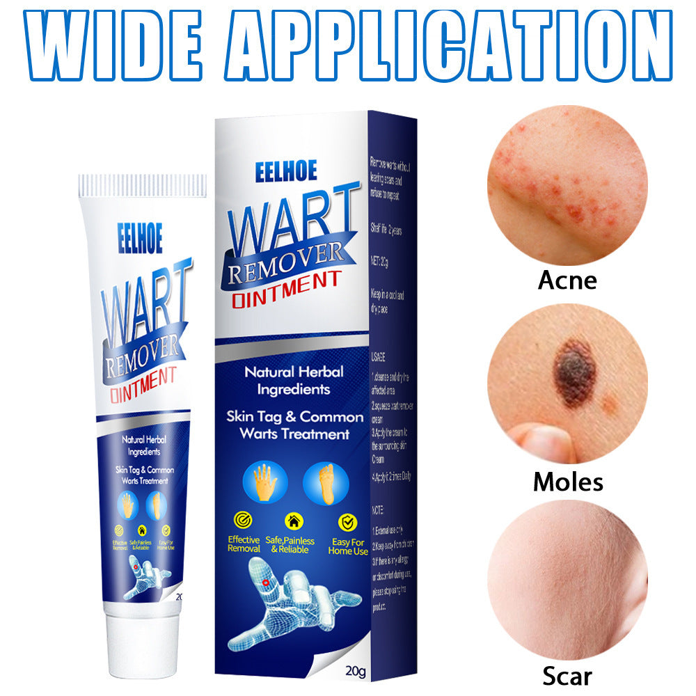 Zhongcao Keyou Liquid Skin Warts Ordinary Yukeyou Skin care lotion Wart Removing Cream.