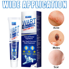 Zhongcao Keyou Liquid Skin Warts Ordinary Yukeyou Skin care lotion Wart Removing Cream.