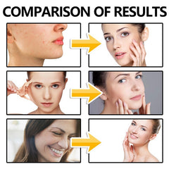 Facial Care Solution Skin Moisturizing And Translucent.