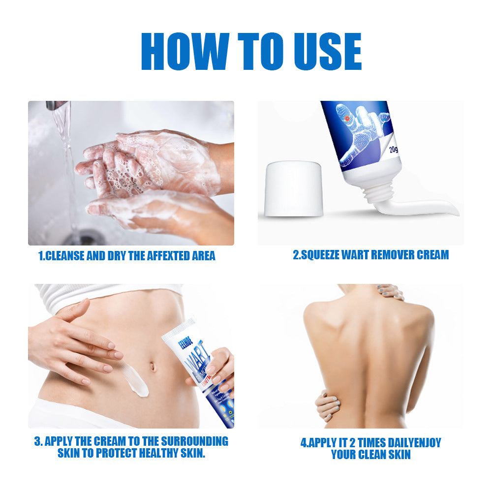 Zhongcao Keyou Liquid Skin Warts Ordinary Yukeyou Skin care lotion Wart Removing Cream.