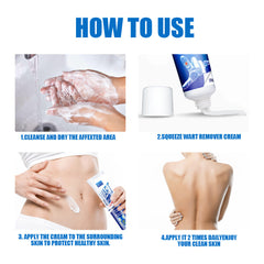 Zhongcao Keyou Liquid Skin Warts Ordinary Yukeyou Skin care lotion Wart Removing Cream.