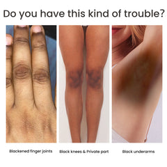 Women's Skin Pigmentation Care.