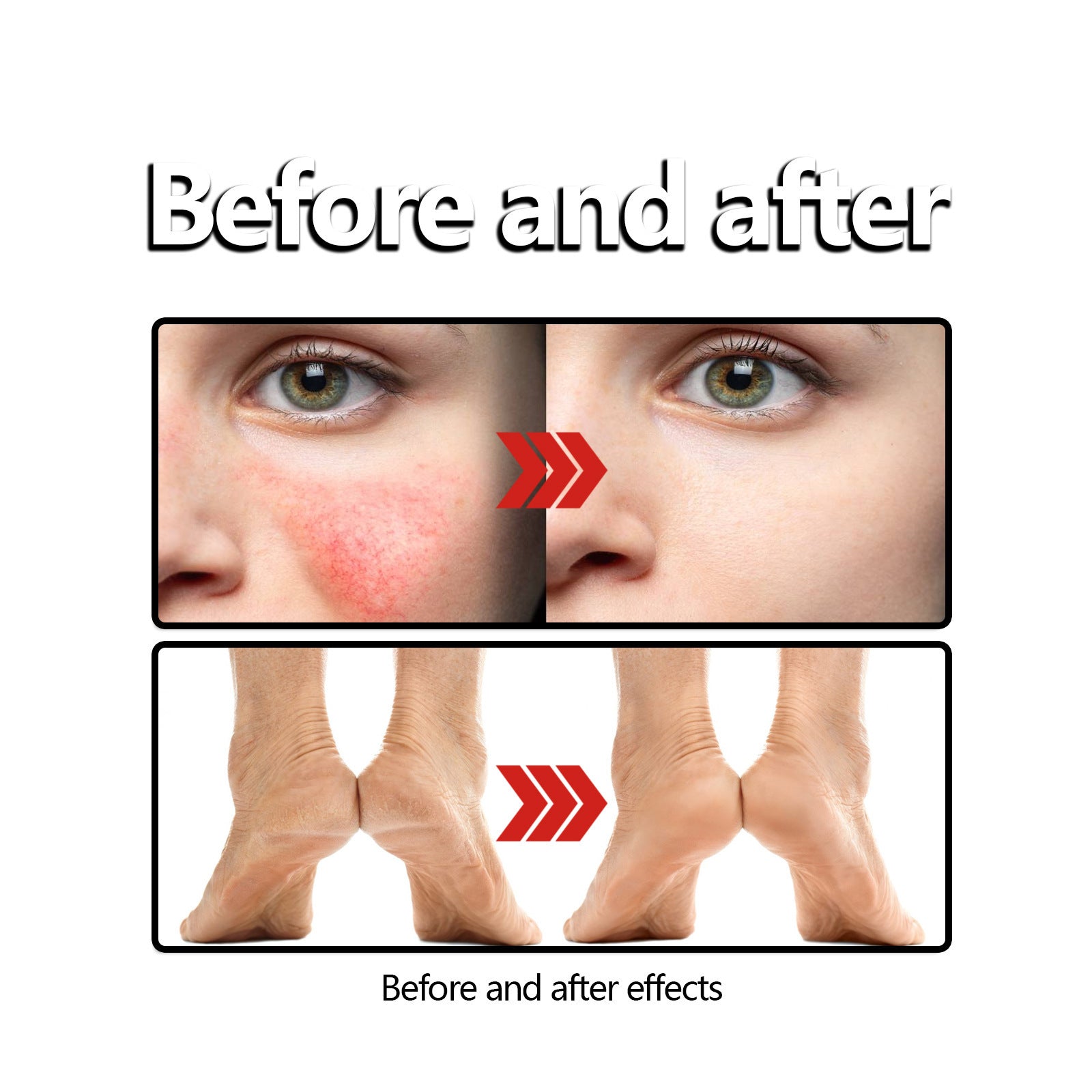 Beeswax Skin Cream Relieves Sunscreen Anti-itch Skin care lotion.
