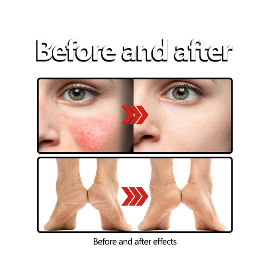 Beeswax Skin Cream Relieves Sunscreen Anti-itch Skin care lotion.