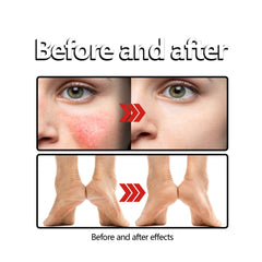 Beeswax Skin Cream Relieves Sunscreen Anti-itch Skin care lotion.
