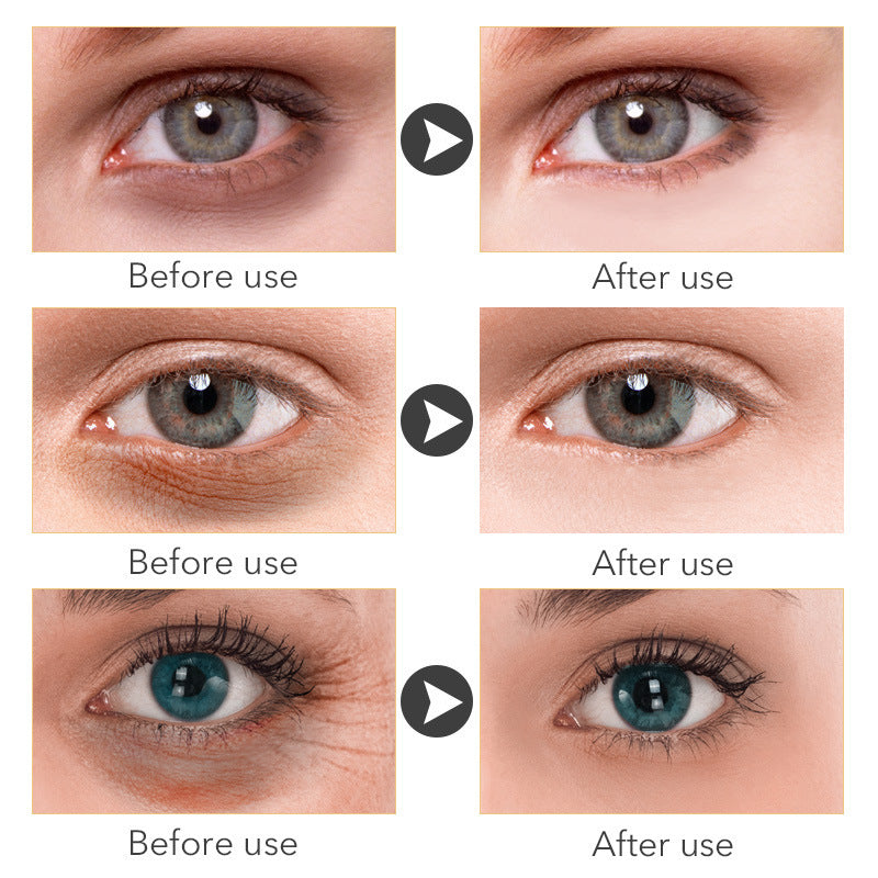 Beauty Eye Cream30mlwish Women's Skin Care Products.