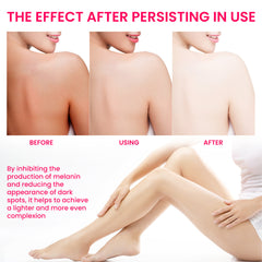 Women's Skin Pigmentation Care.